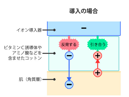 イオン導入の模式図